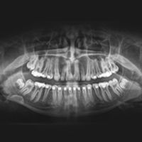 Radiografia-Panoramica